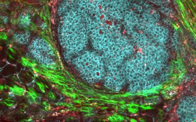 Workshop: Tumor Immunology Meets Infectious Diseases (TIMID)